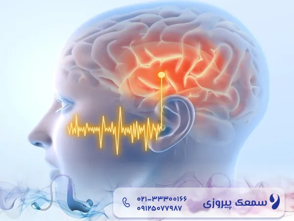 اثر آلودگی صوتی بر مغز
